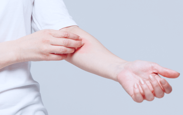 Аллергические реакции